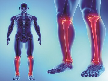 Best Orthopedic Doctor in Hyderabad