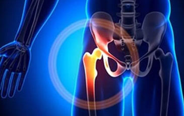 Bone Specialist in Hyderabad