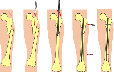 Best Orthopedic Doctor in Hyderabad