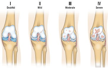 Orthopedic Specialist in Begumpet